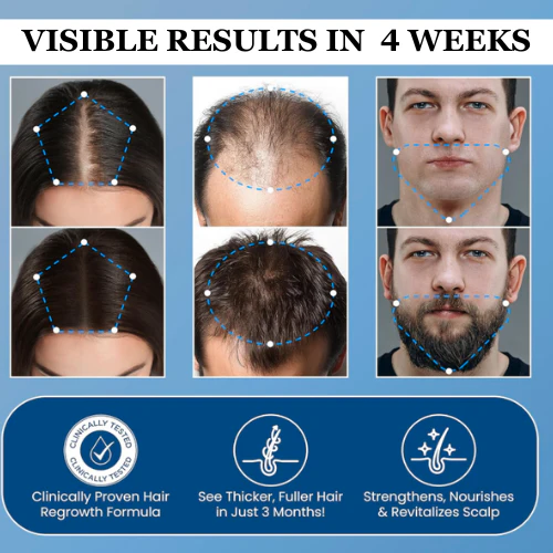 Aparthy Hair Growth Roll on Serum - Image 6