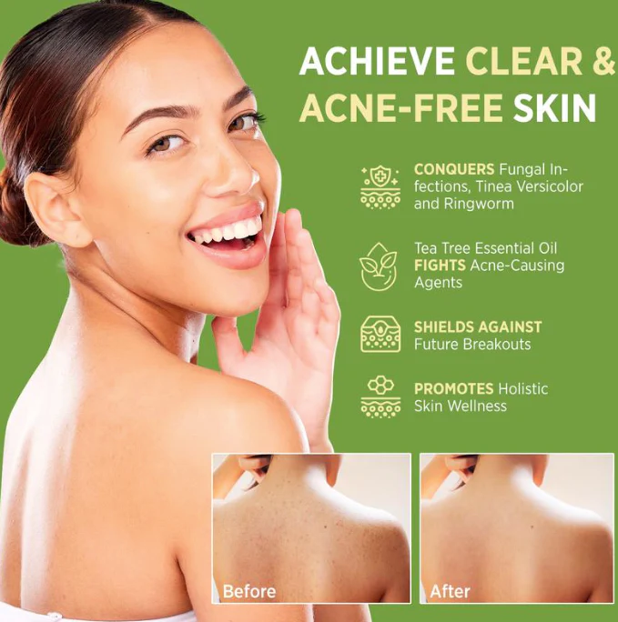 Tea Tree Soap - Image 4